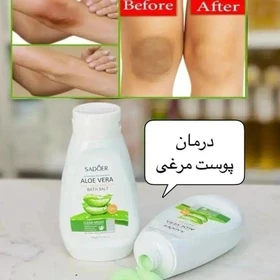 نمک بدن آلوئه ورا سادور  رفع تیرگی نقاط حساس و رفع پوست تخم مرغی اصل وارداتی